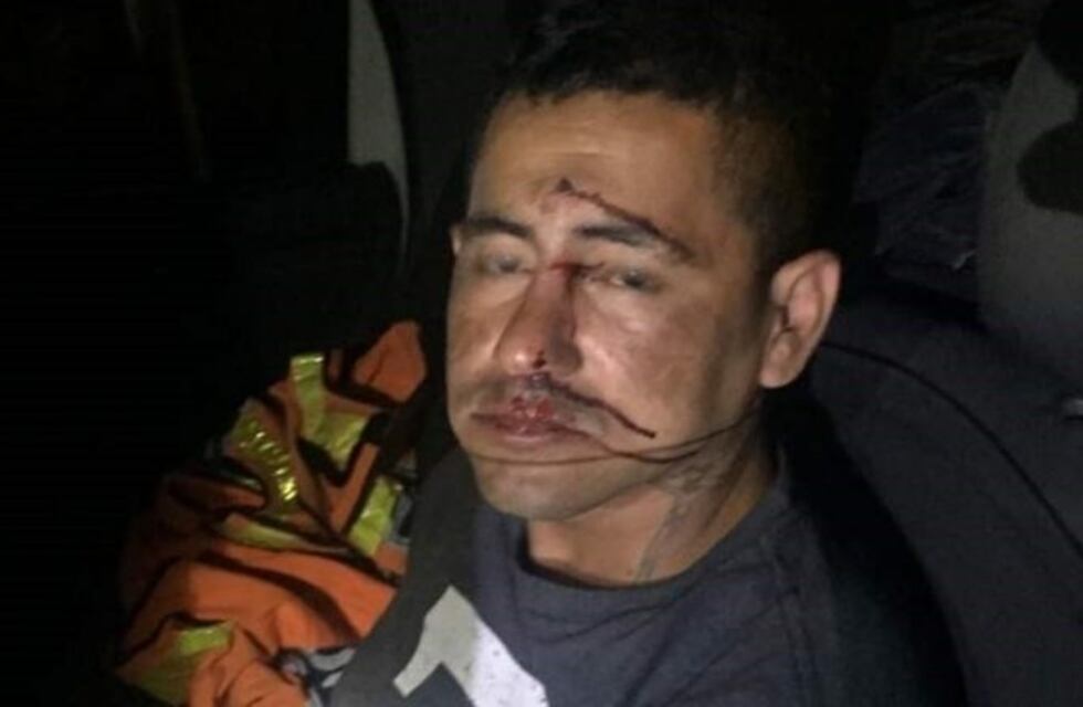 Lo atraparon robando los parlantes de un auto y casi lo linchan