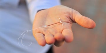 Bebé nació con un DIU pegado en su cabeza\u002E (web)\u002E