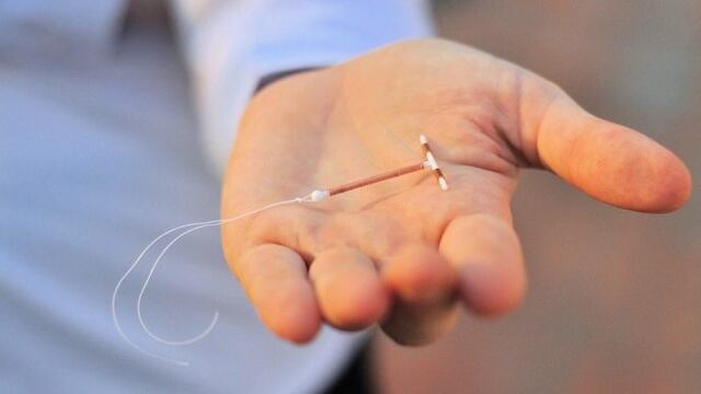 Bebé nació con un DIU pegado en su cabeza\u002E (web)\u002E