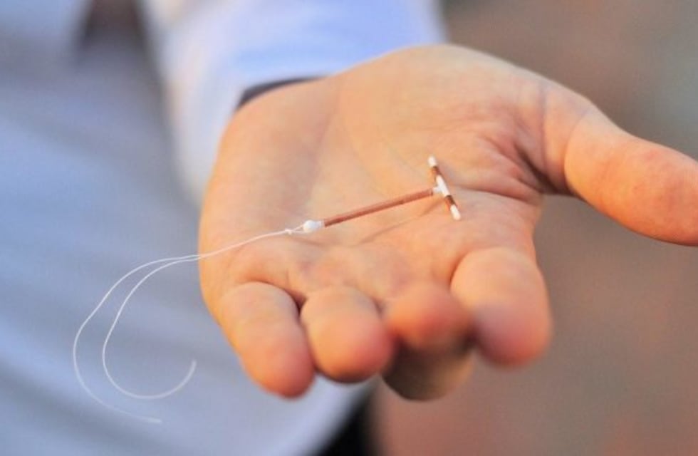 Se volvió viral la foto de un bebé que nació con un DIU pegado a su cabeza