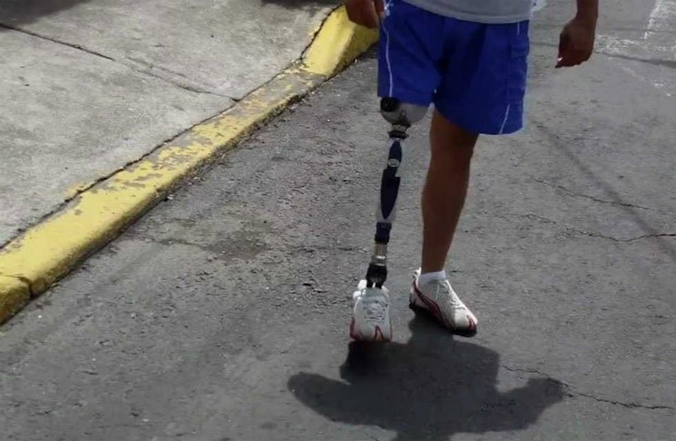 Le robaron una pierna ortopédica valuada en 150 mil pesos