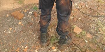 Los uniformados terminaron lastimados por el forcejeo con los detenidos\u002E