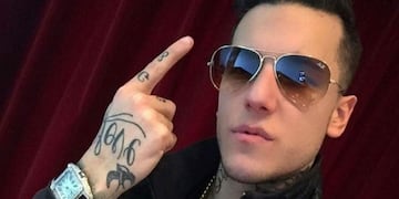 Alex Caniggia se operó la nariz y mostró el resultado