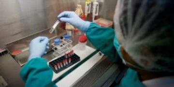 A health technician analyses blood samples for tuberculosis testing in a high-tech tuberculosis lab in Carabayllo in Lima, Peru May 19, 2016. REUTERS/Mariana Bazo SEARCH