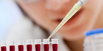 Investigadores de la Universidad de Rosario avanzaron en la lucha contra la Tuberculosis