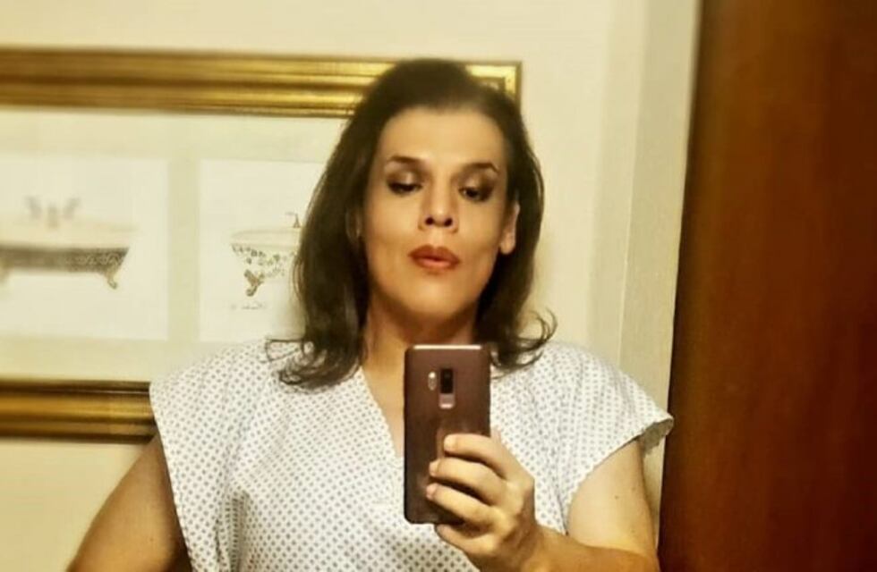 Costa se realizó una cirugía estética: "Me saqué toda la grasa"