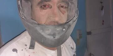 El sanjuanino quedó en medio del ventarrón y se convirtió en meme\u002E