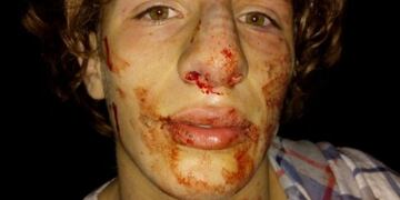 Augusto Laspiur está internado como consecuencia de las graves heridas sufridas\u002E