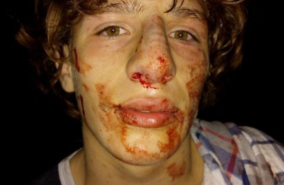 Molieron a golpes a seis pibes a la salida de un cumpleaños de 15