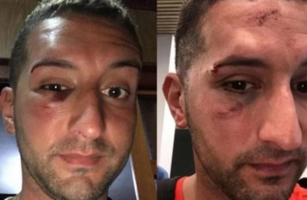 Pese a la polémica por la agresión al turista, no descartan otra movilización