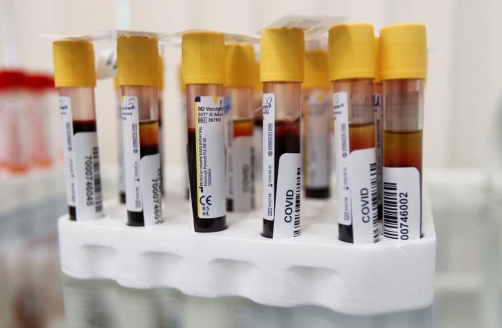 Coronavirus en Chaco: un muerto y once nuevos casos