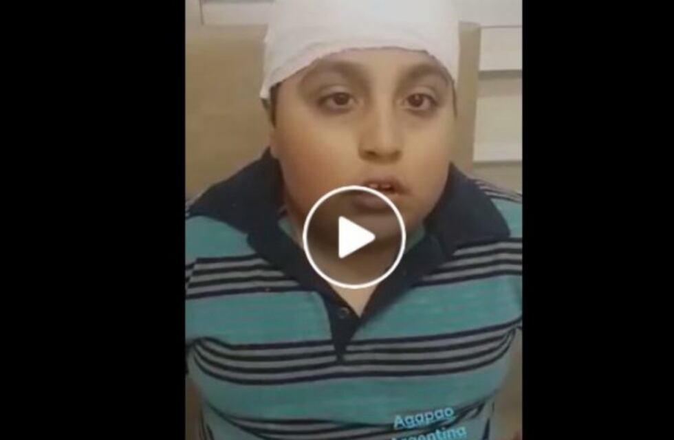 Un niño que perdió la vista por un tumor sueña con conocer a Tevez