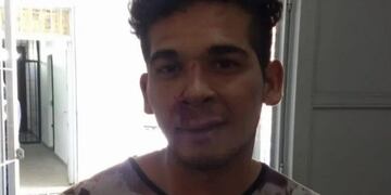 El sujeto fue detenido tras golpear a su ex\u002E