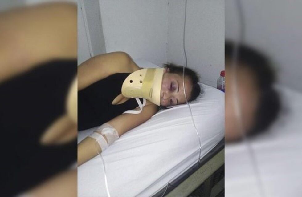 "Traté de defenderme pero no pude", comentó la joven agredida por una boxeadora en La Plata