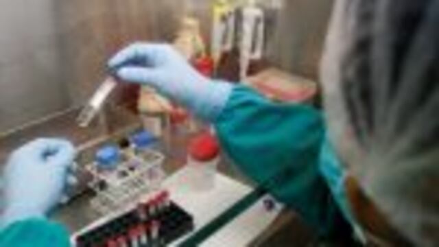 A health technician analyses blood samples for tuberculosis testing in a high-tech tuberculosis lab in Carabayllo in Lima, Peru May 19, 2016. REUTERS/Mariana Bazo SEARCH