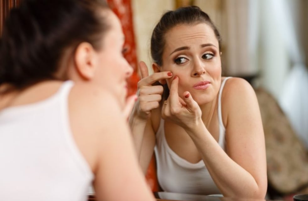 Acné después de los 40, más común de lo que se cree