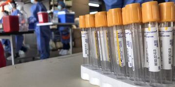 Por el aumento de casos, desde este lunes se endurecen las restricciones\u002E