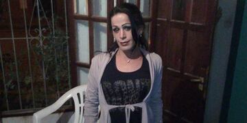 La mujer trans agredida, Mirna Dimarzo\u002E (Web)