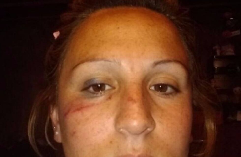 Habló la jugadora que fue golpeada por un director técnico en un partido de fútbol
