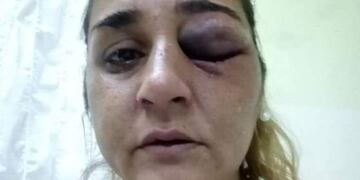 Celia Castro víctima de violencia de género.