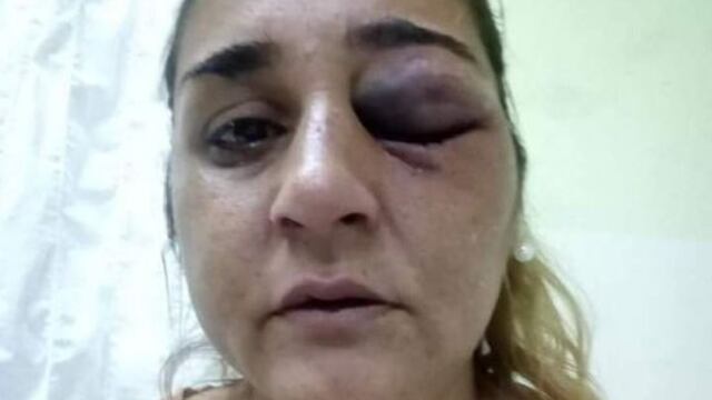 Celia Castro víctima de violencia de género.