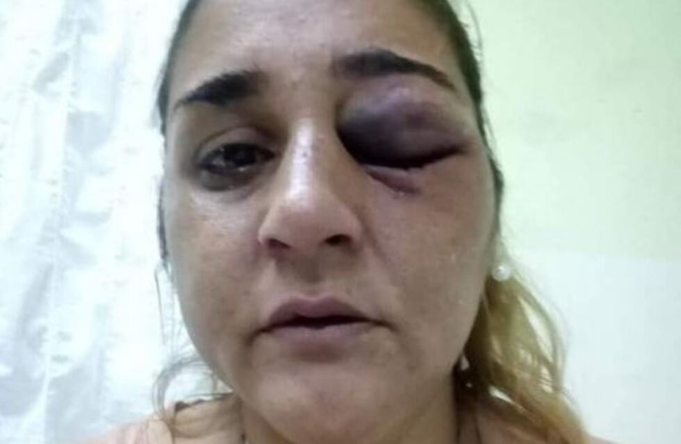 Celia Castro: “Me arruinó como mujer psicológicamente”