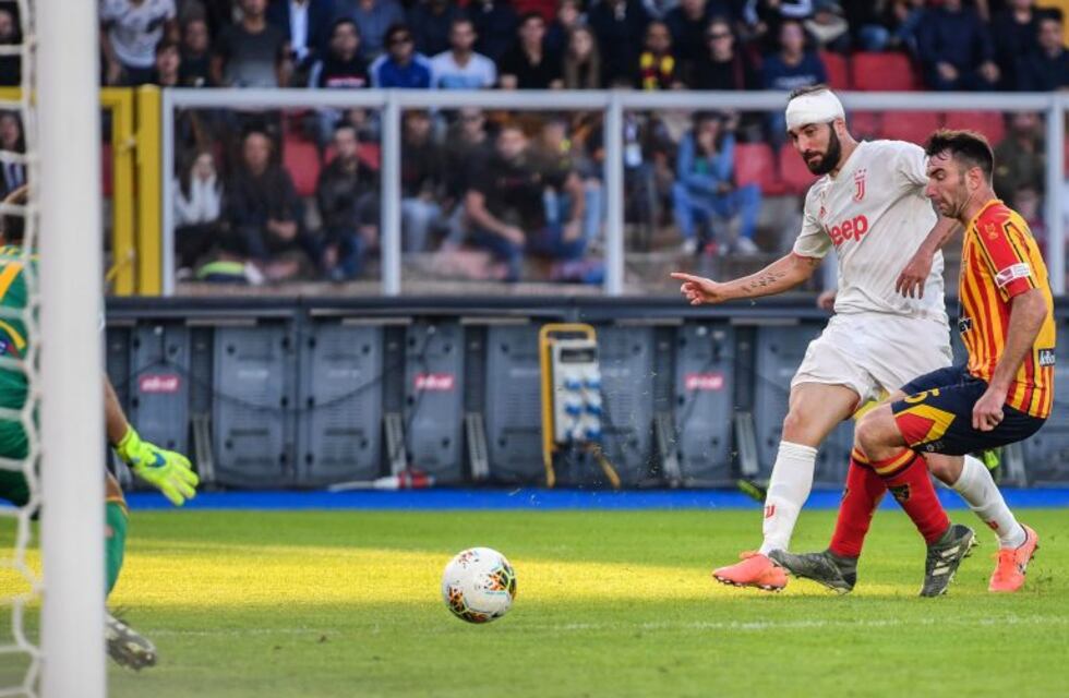Gonzalo Higuaín sufrió un duro golpe  en la cabeza en el partido de Juventus ante Lecce
