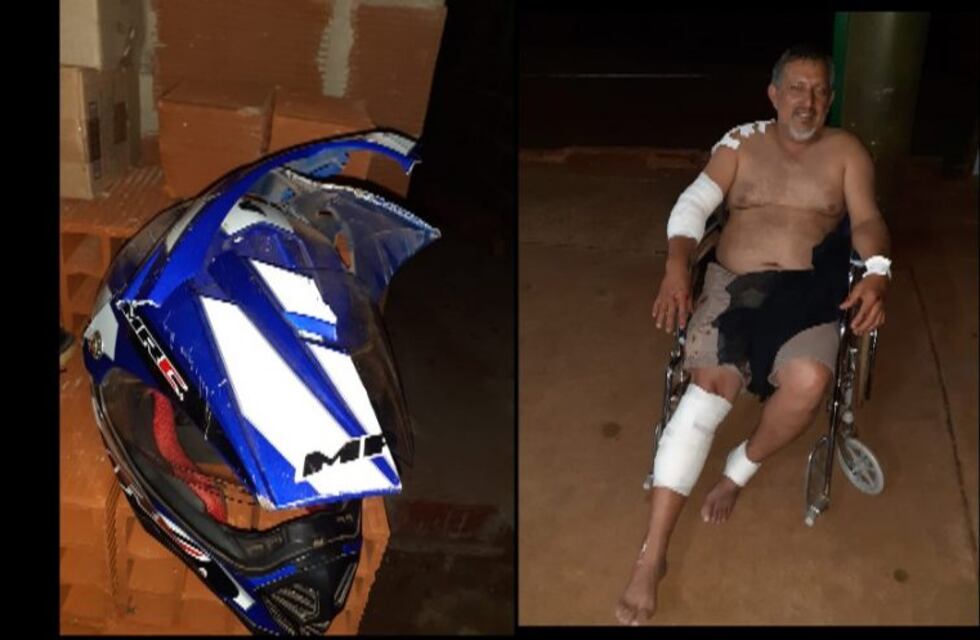 Vecino de Iguazú todavía se recupera después de atropellar con su moto a un caballo