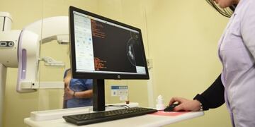 El cáncer de cuello y útero es más prevenible a través de la realización del PAP\u002E