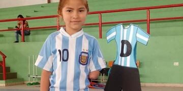 Juanita recibirá una prótesis 3D