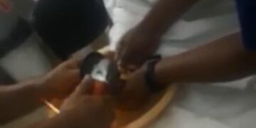 Los médicos del hospital de Maciel estuvieron a cargo del procedimiento con al amoladora\u002E (Captura de pantalla)