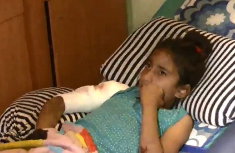 Nena de 9 años sufrió el ataque feroz de un rottweiler en Capitán Bermúdez