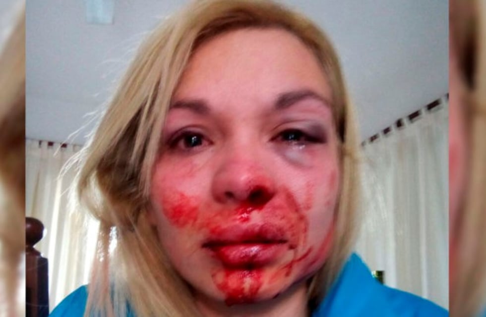 La personal trainer golpeada llegó a un acuerdo con su novio y se suspendió el juicio