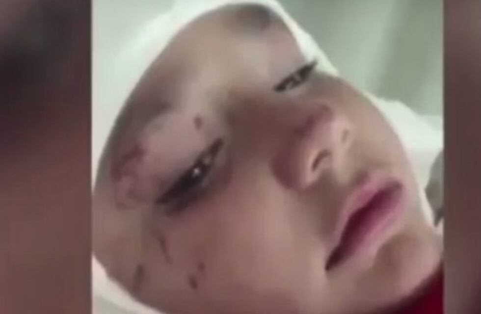 El niño golpeado por un poste en una cancha de fútbol no recuerda lo que ocurrió