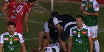 Sufrió una fractura de peroné y tuvo que ser trasladado al hospital en el baúl de un taxi\u002E