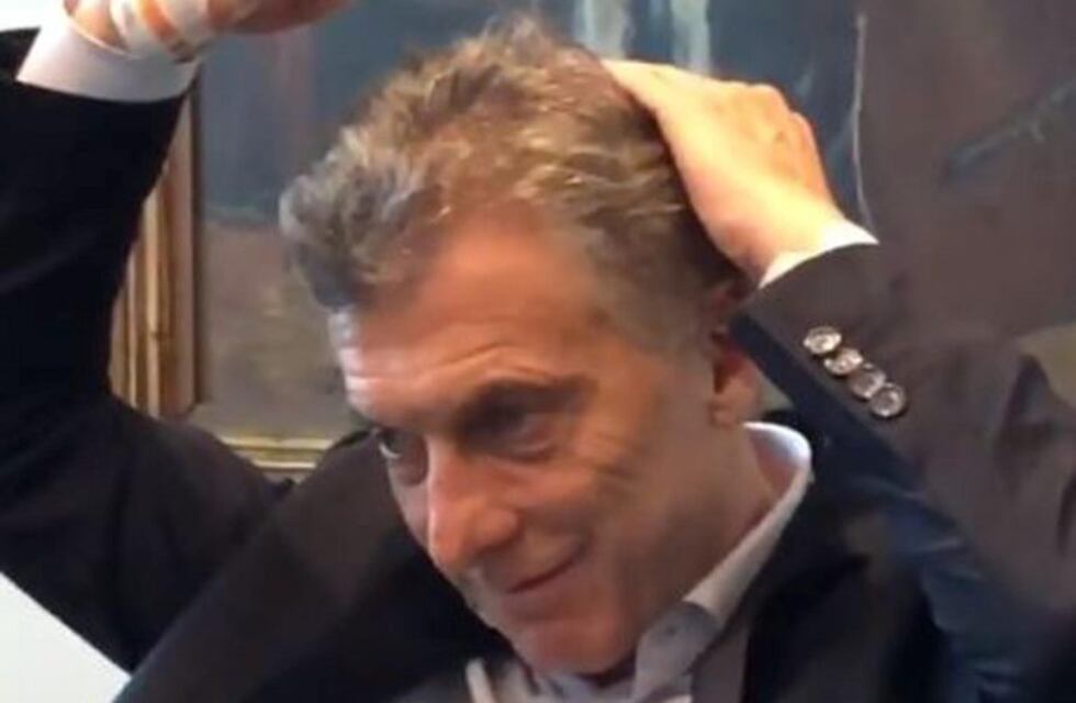 Mauricio Macri mostró cómo se coloca un producto para la calvicie