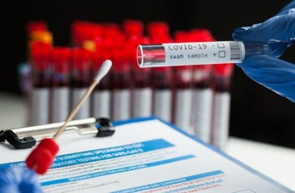 Denuncian "servicios clandestinos e irregulares" con test de Covid-19