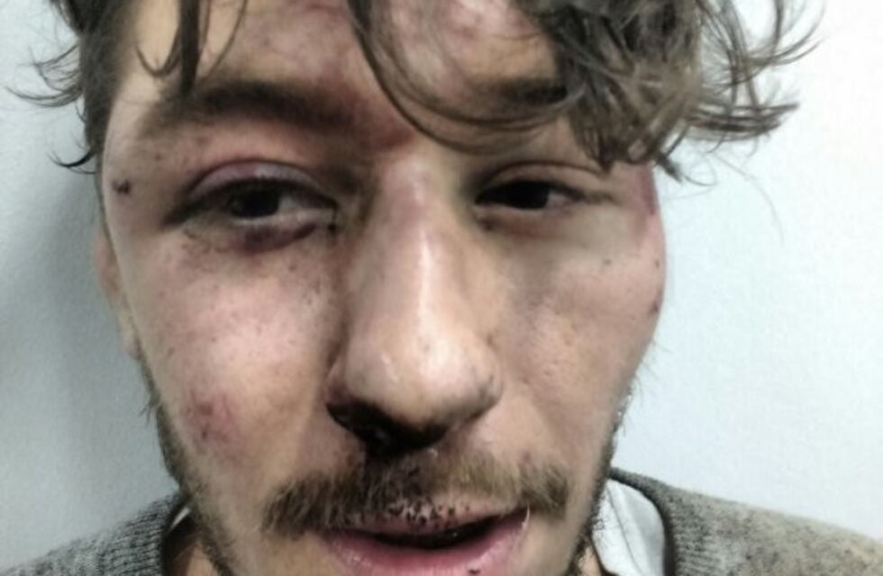 Denunciaron que la Policía de la Ciudad dio una "brutal golpiza" a dos jóvenes en Floresta