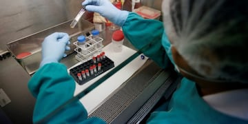 A health technician analyses blood samples for tuberculosis testing in a high-tech tuberculosis lab in Carabayllo in Lima, Peru May 19, 2016\u002E REUTERS/Mariana Bazo SEARCH \