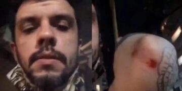 Ataque homofóbico en Palermo (Web)