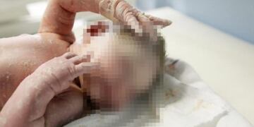 Rodrigo, el bebé que nació sin rostro, ya habla\u002E (Web)