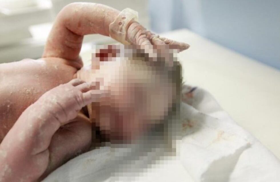 Rodrigo nació sin ojos, nariz y parte del cráneo: a los 4 meses, empezó a hablar