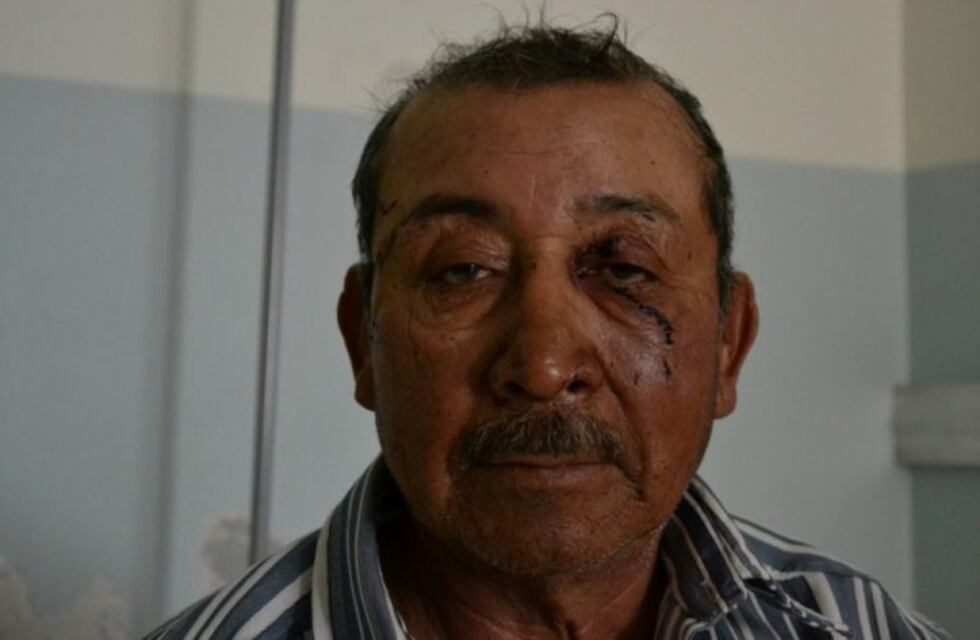 Un estanciero de 64 años peleó cuerpo a cuerpo contra un puma para salvar a su perro