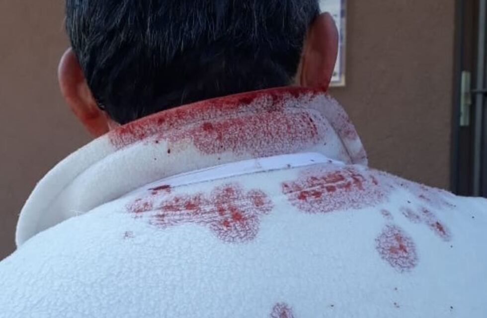 Mujer recibió un disparo cuando vecinos trataban de detener a ladrones