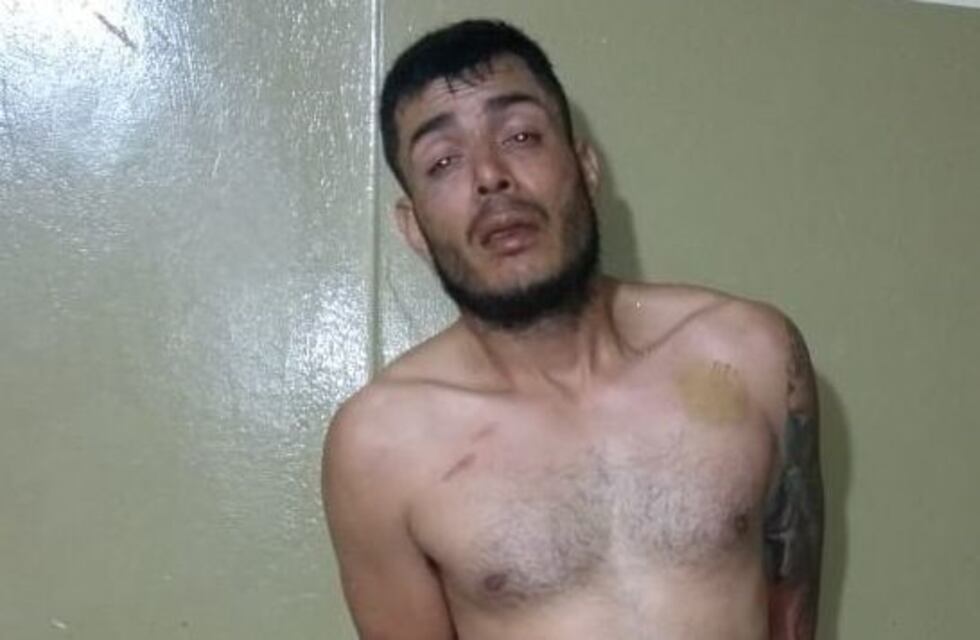 Salta: un colombiano le propinó una brutal paliza a una salteña en un hotel