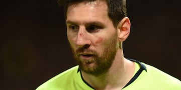Lionel Messi, sin lesión tras el golpe en la cara\u002E (AFP)