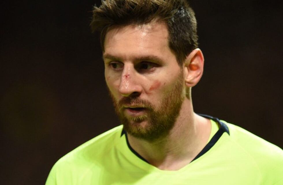 Messi, sin lesión tras el golpe que sufrió en la cara en el partido ante Manchester United