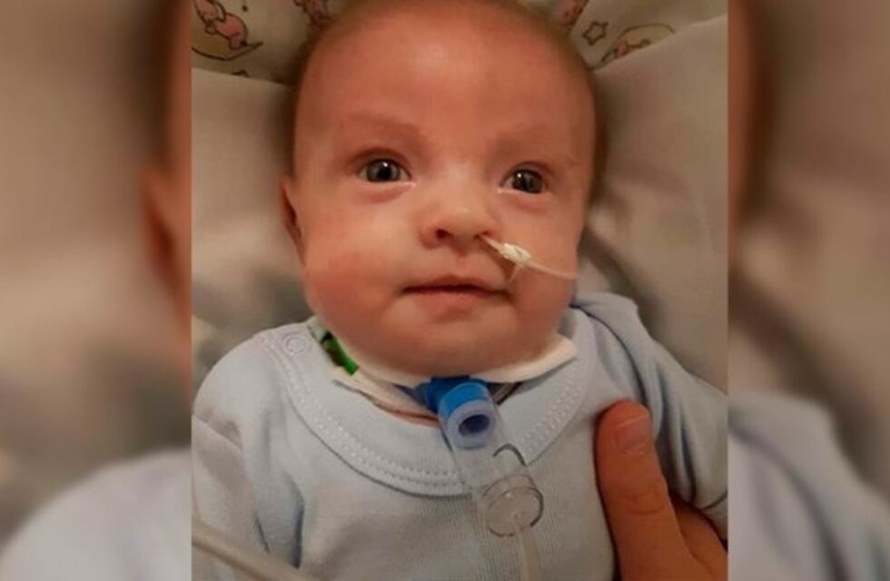 "Estamos ansiosos de volver a casa con ella", dijo la madre de la beba que padece una extraña patología