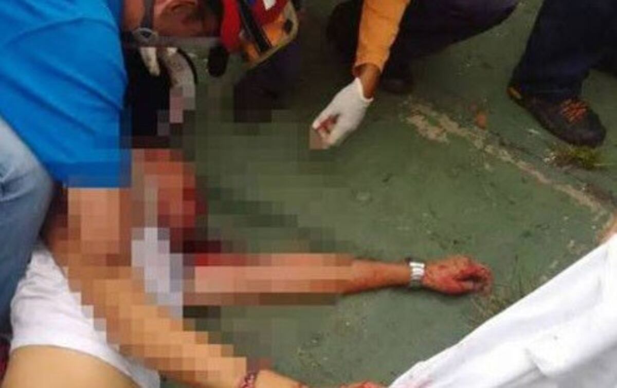 Al joven le efectuaron un disparo en el abdomen y fue trasladado al Hospital Central.