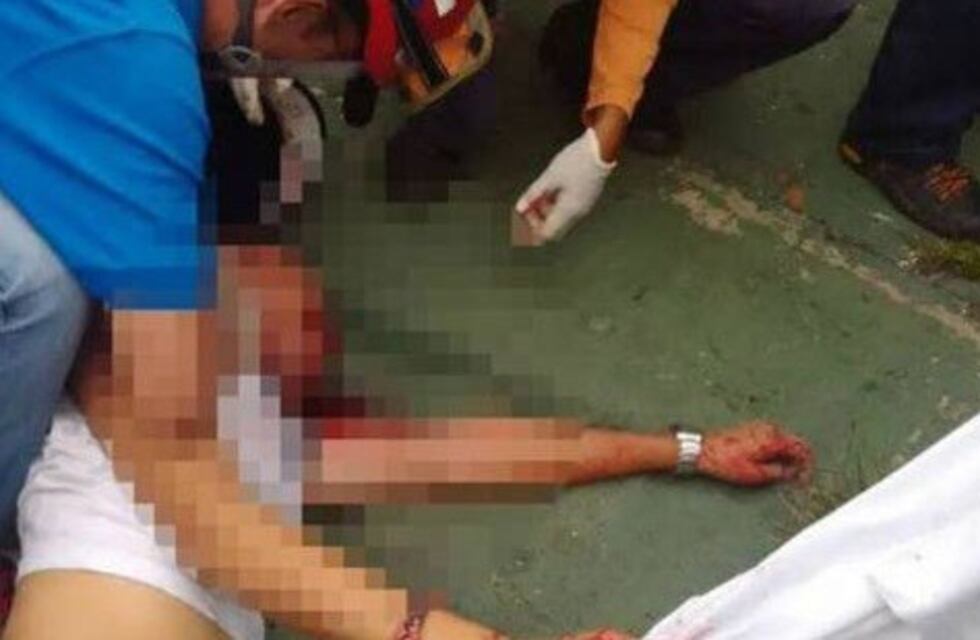 Un joven fue baleado en Ciudad y está grave